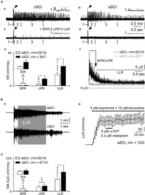 The Involvement of CaV1.3 Channels in Prolonged Root Reflexes and Its Potential as a Therapeutic Target in Spinal Cord Injury